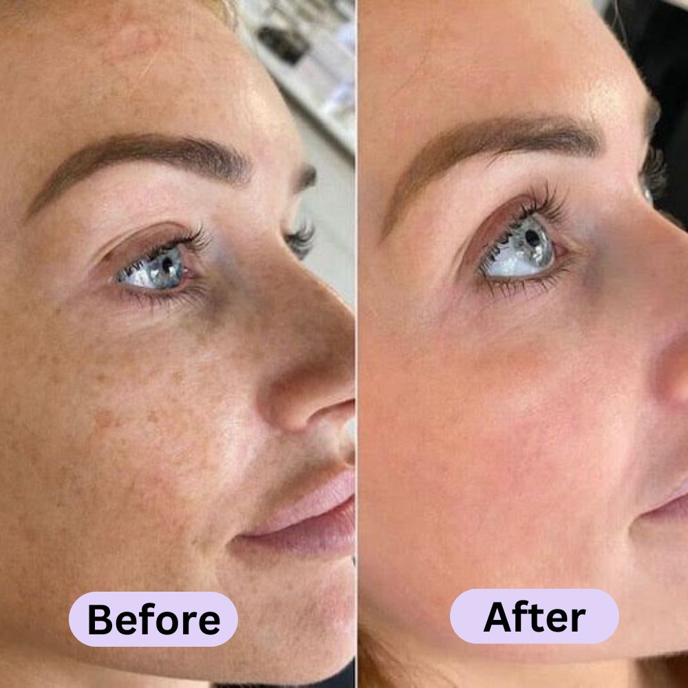 ENHANSE LED Light Therapy Mask